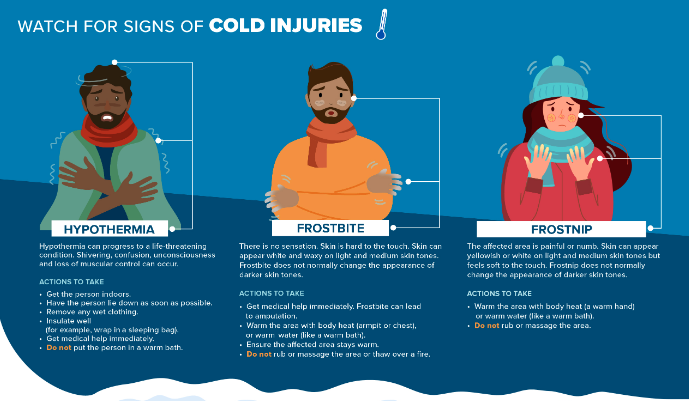 聖誕寒流襲英加 移民港人需知3大凍傷特徵